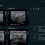 Roundup: Lunit gets new CE mark for AI DBT solution and more briefs